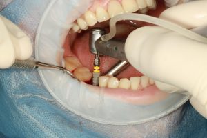 dental-3754769_1280